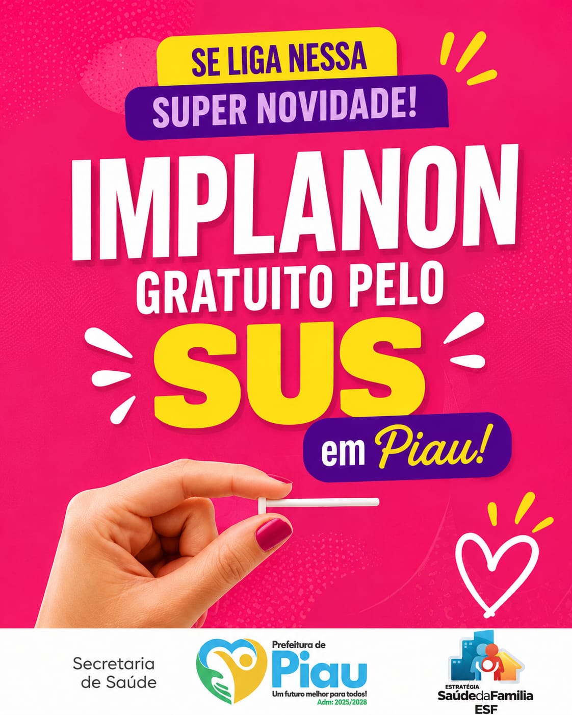 Implanon no SUS: Saúde de Piau Informa Novidade para Mulheres Acima de 14 Anos